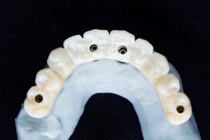 High Quality Dentures