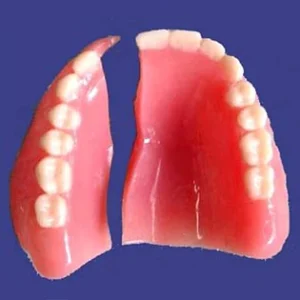 A broken set of dentures that have cracked down the middle