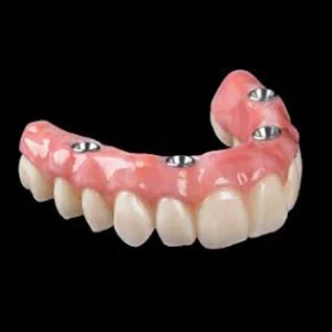 Close up of a set of implant dentures