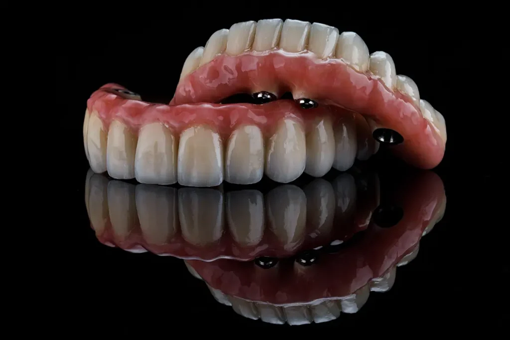 Upside down implant denture stacked on top of another implant denture.